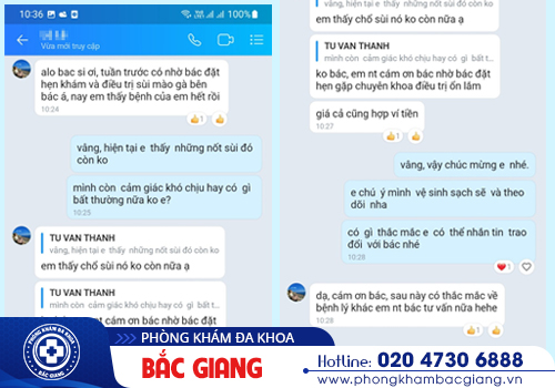 Đốt sùi mào gà và những điều cần biết khi điều trị