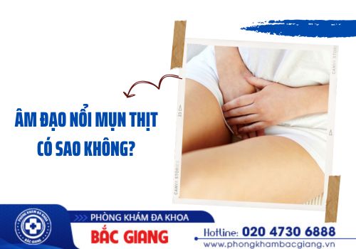 âm đạo nổi mụn thịt có sao không