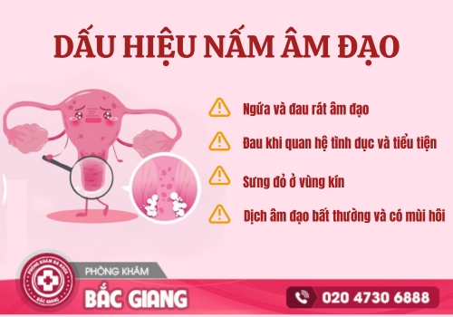 nấm âm đạo