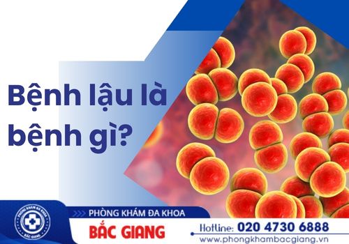 bệnh lậu là bệnh gì