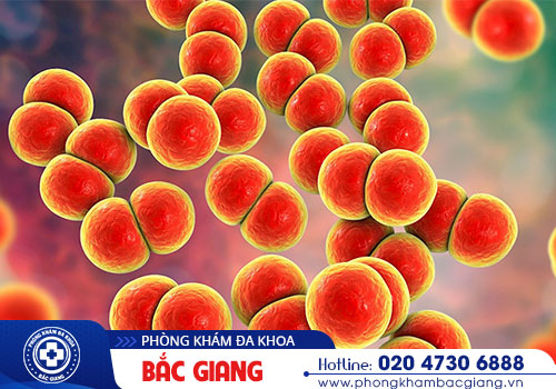 Bệnh lậu: Nguyên nhân, Triệu chứng và Cách điều trị