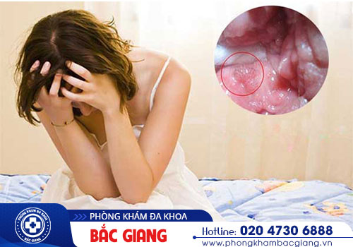 Bệnh lậu: Nguyên nhân, Triệu chứng và Cách điều trị