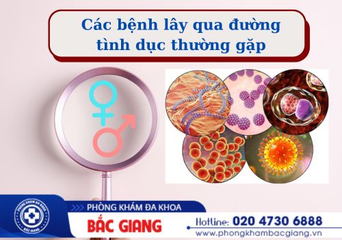 các bệnh lây qua đường tình dục