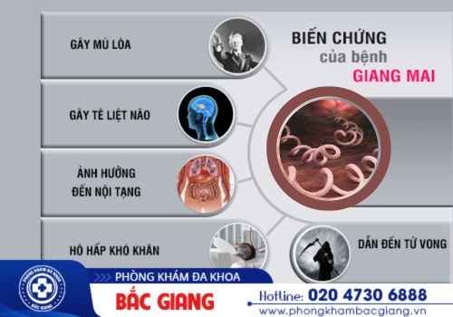 Dấu hiệu nhận biết bệnh giang mai