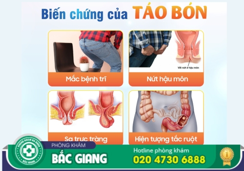 địa chỉ chữa táo bón ở bắc giang