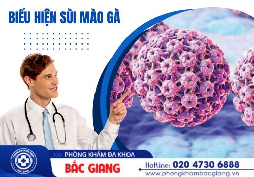 biểu hiện sùi mào gà