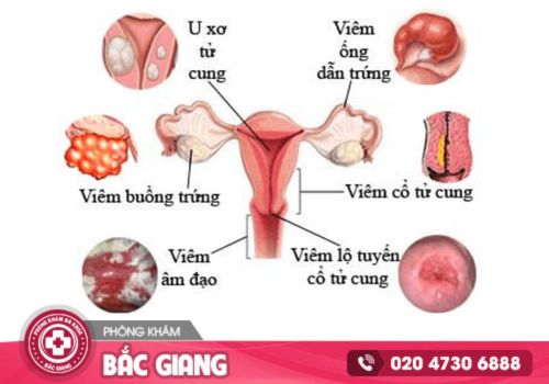 phòng khám phụ khoa