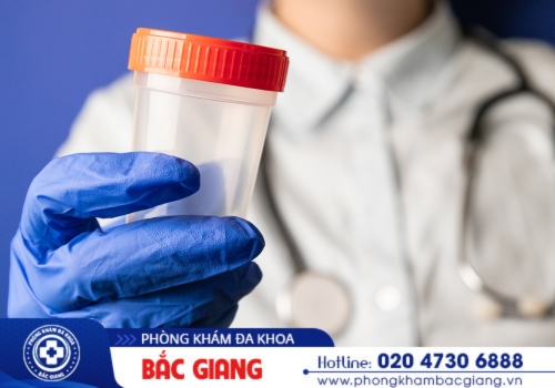 cách chữa tinh trùng bị vón cục