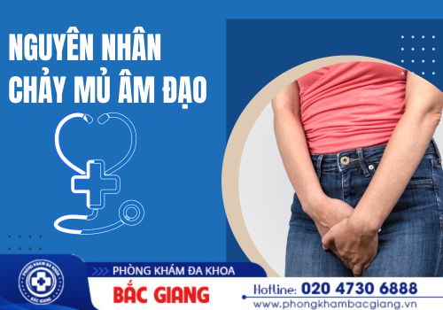 chảy mủ âm đạo