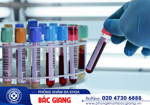 Chi phí cho 1 lần xét nghiệm tổng quát bệnh xã hội là bao nhiêu?