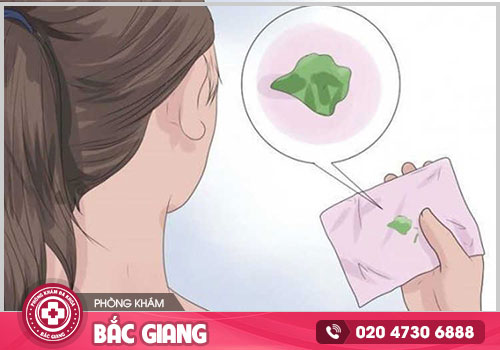 Chi phí chữa khỏi khí hư bất thường tại Bắc Giang có mắc không? Hết bao nhiêu tiền?