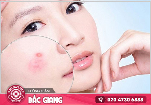 Chi phí chữa rối loạn nội tiết tố nữ ở Bắc Giang là bao nhiêu? Có mắc không?