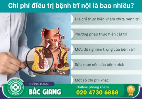 chi phí điều trị bệnh trĩ nội tại bắc giang