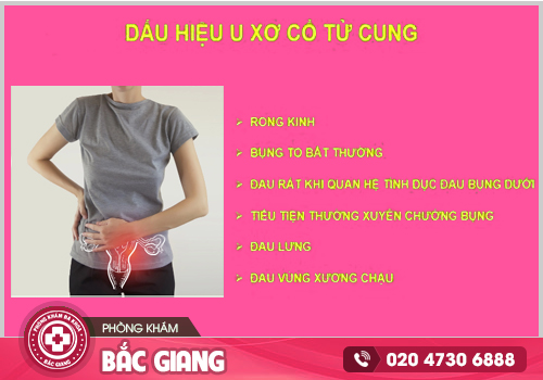 Chi phí điều trị u xơ tử cung tại Bắc Giang có đắt không? Chữa ở đâu an toàn?