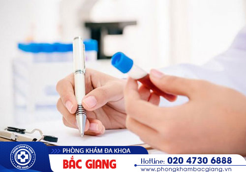 Chi phí xét nghiệm giang mai có đắt không?