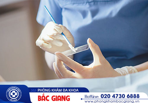 Chi phí xét nghiệm giang mai có đắt không?