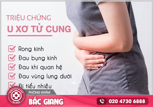Chữa bệnh u xơ tử cung ở Bắc Giang không thể bỏ qua địa chỉ này