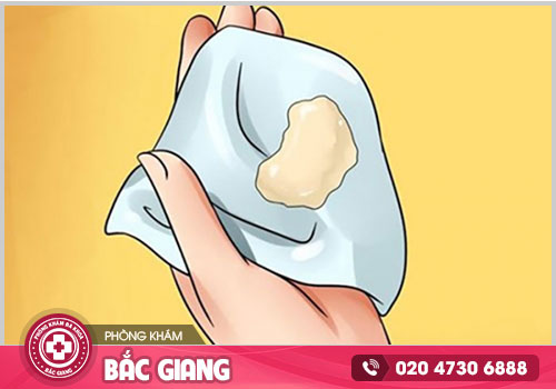 Chữa viêm âm đạo tại Bắc Giang ở đâu hiệu quả, an toàn?