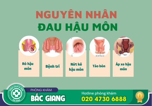 điều trị bệnh đau hậu môn ở bắc giang