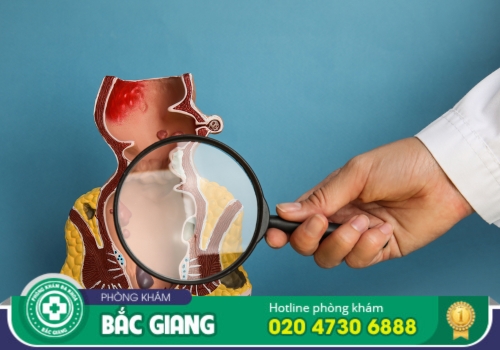 chữa đi ngoài ra máu tại bắc giang