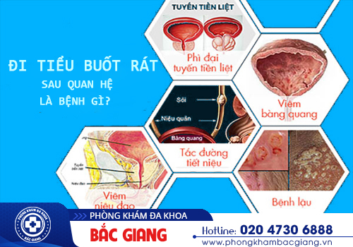 Đi tiểu bị buốt rát sau quan hệ là bị gì? Có nguy hiểm không?