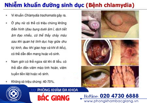 Đi vệ sinh rát buốt là bệnh gì? Mối đe doạ nguy hiểm đối với sức khoẻ