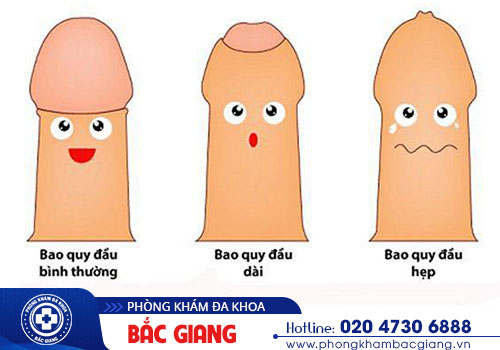 Địa chỉ cắt bao quy đầu thẩm mỹ tại Bắc Giang nào tốt?