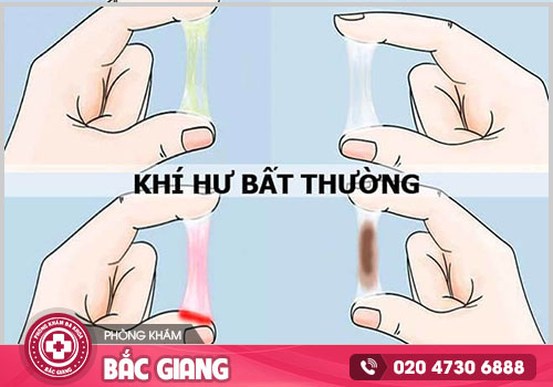 Địa chỉ khám khí hư bất thường tại Bắc Giang nào chất lượng tốt?