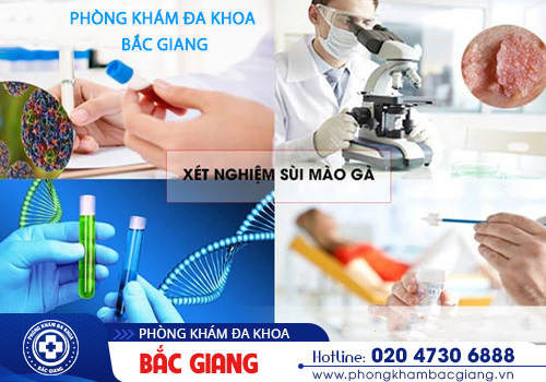 Khi nào cần xét nghiệm sùi mào gà?