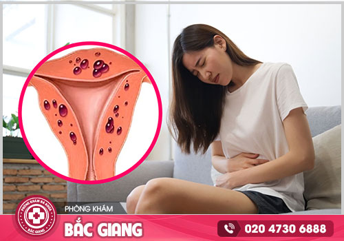 Điểm danh địa chỉ khám và điều trị đau bụng kinh ở Bắc Giang chất lượng tốt