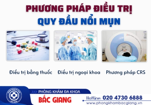 quy đầu nổi mụn