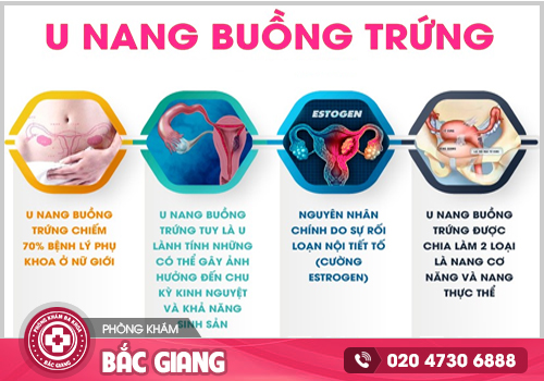 Điều trị u nang buồng trứng ở Bắc Giang cùng chuyên gia đầu ngành
