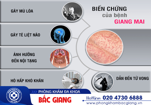 Giang mai - Căn bệnh tình dục nguy hiểm đe doạ trực tiếp đến sự sống người bệnh