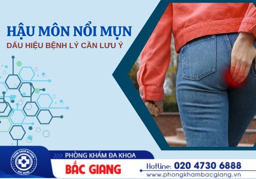 hậu môn nổi mụn 