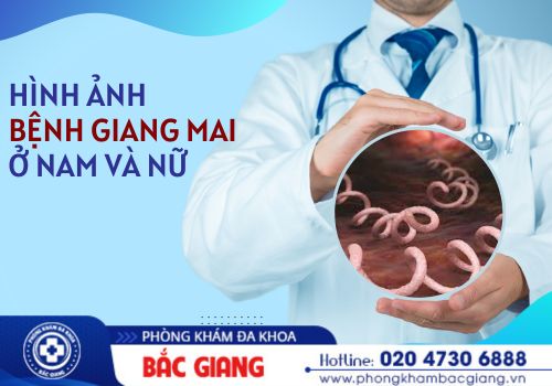 hình ảnh giang mai ở nam và nữ
