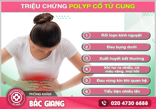 Khám và điều trị Polyp cổ tử cung ở Bắc Giang cùng chuyên gia đầu ngành
