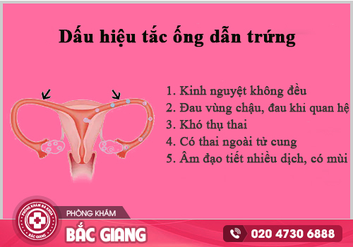 Lựa chọn địa chỉ khám và điều trị tắc ống dẫn trứng ở Bắc Giang