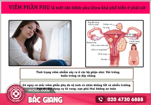 Cơ sở khám và điều trị viêm phần phụ tại Bắc Giang được trực thuộc Sở y tế