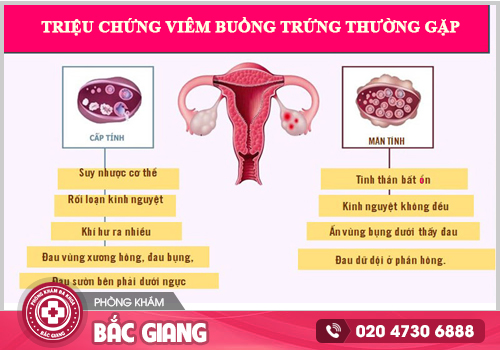 Khám viêm buồng trứng tại Bắc Giang cùng chuyên gia y tế đầu ngành