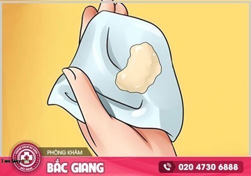 Khí hư bất thường nguyên nhân do đâu? Có ảnh hưởng gì không?