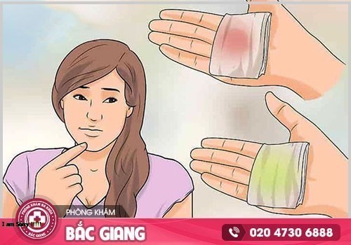 Khí hư bất thường nguyên nhân do đâu? Có ảnh hưởng gì không?