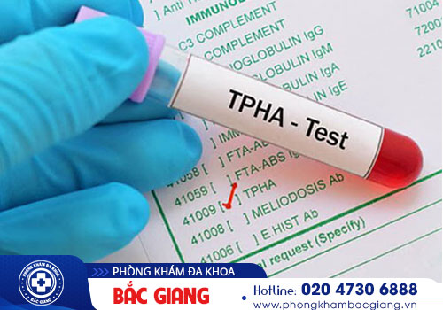 Khi nào thì cần thiết xét nghiệm bệnh giang mai?