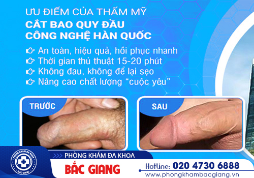 Không cắt bao quy đầu có sao không? 4 tác hại cần biết