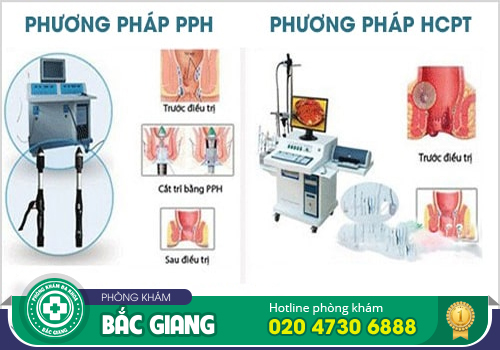 Kiểm tra hậu môn - Phát hiện sớm các bệnh lý hậu môn, trực tràng nguy hiểm