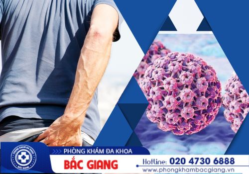 hậu môn nổi mụn thịt có phải bị sùi mào gà