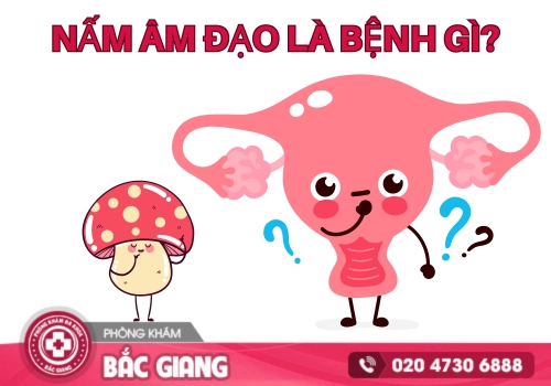 Nấm Âm Đạo
