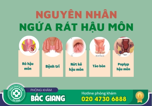 địa chỉ chữa bệnh ngứa rát hậu môn ở bắc giang