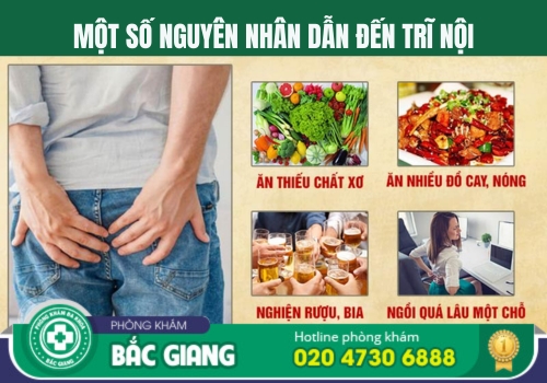 địa chỉ điều trị bệnh trĩ nội tại bắc giang