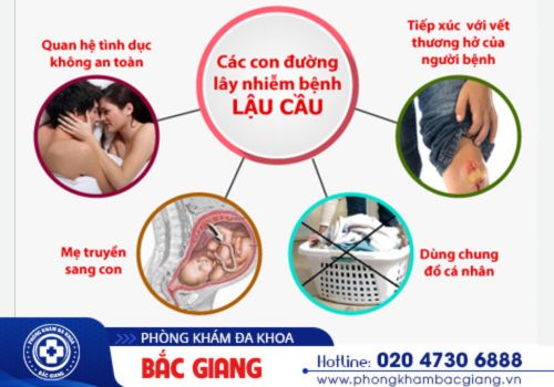 biểu hiện ban đầu của bệnh lậu