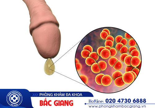 Nguyên nhân khiến nam giới đau buốt khi đi tiểu